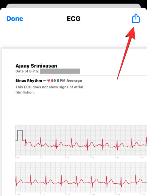 ecg-reading-on-iphone-14-a
