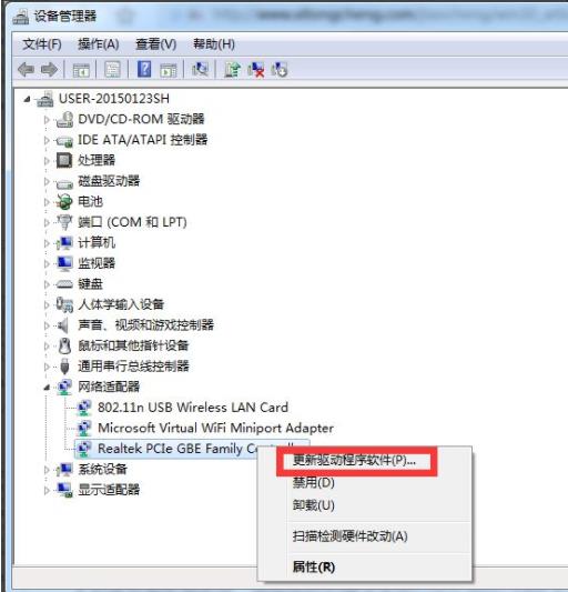 如何恢复消失的Win7本地连接？