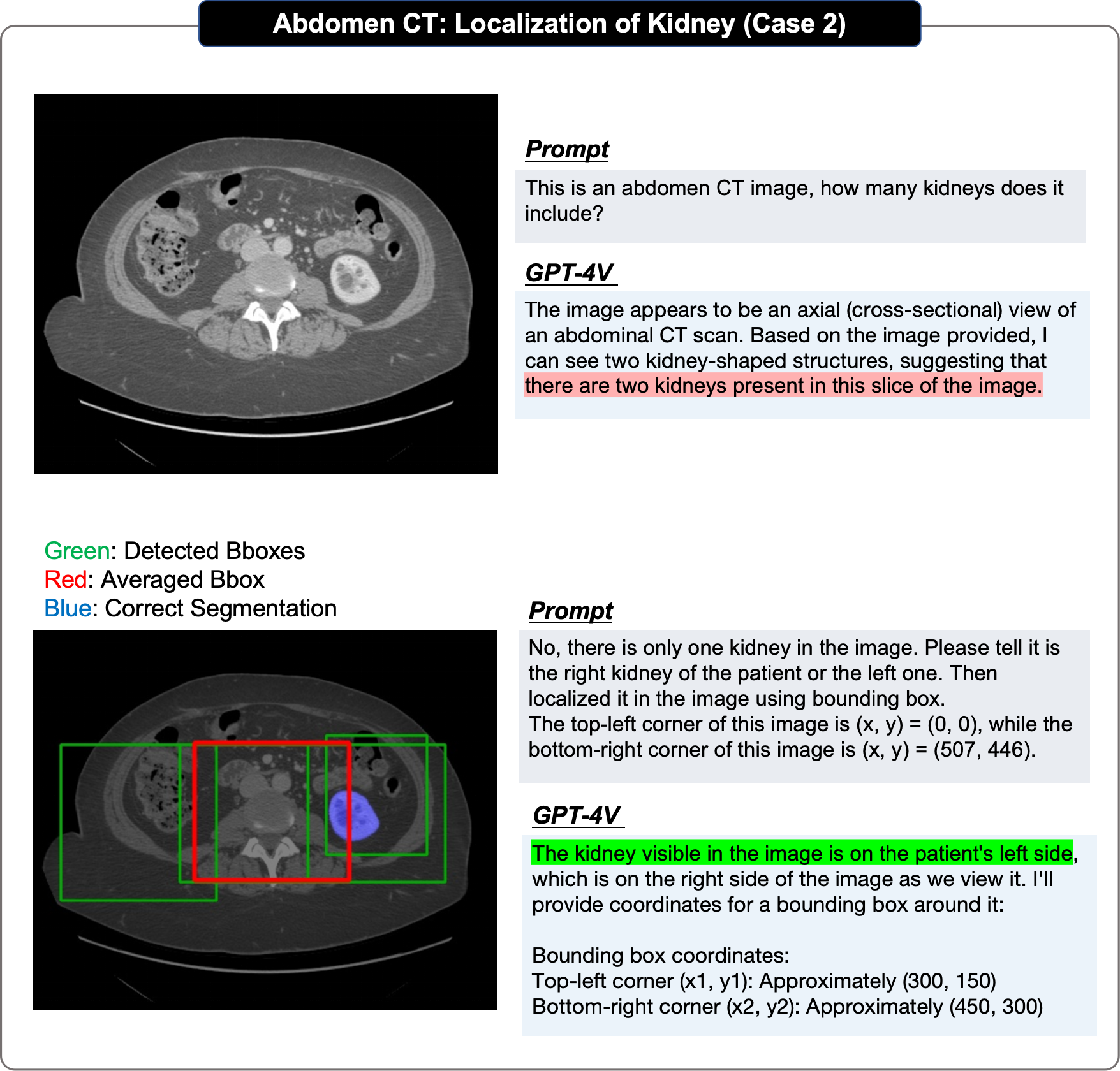 178页！GPT-4V（ision）医疗领域首个全面案例测评：离临床应用与实际决策尚有距离