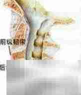 晒太阳防颈椎病？真相揭秘