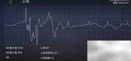 多功能健康仪心电操作指南