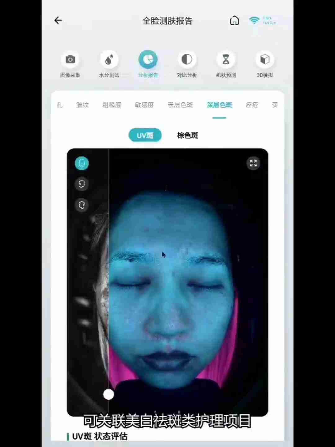 皮肤检测报告解读：深层分析与护理建议
