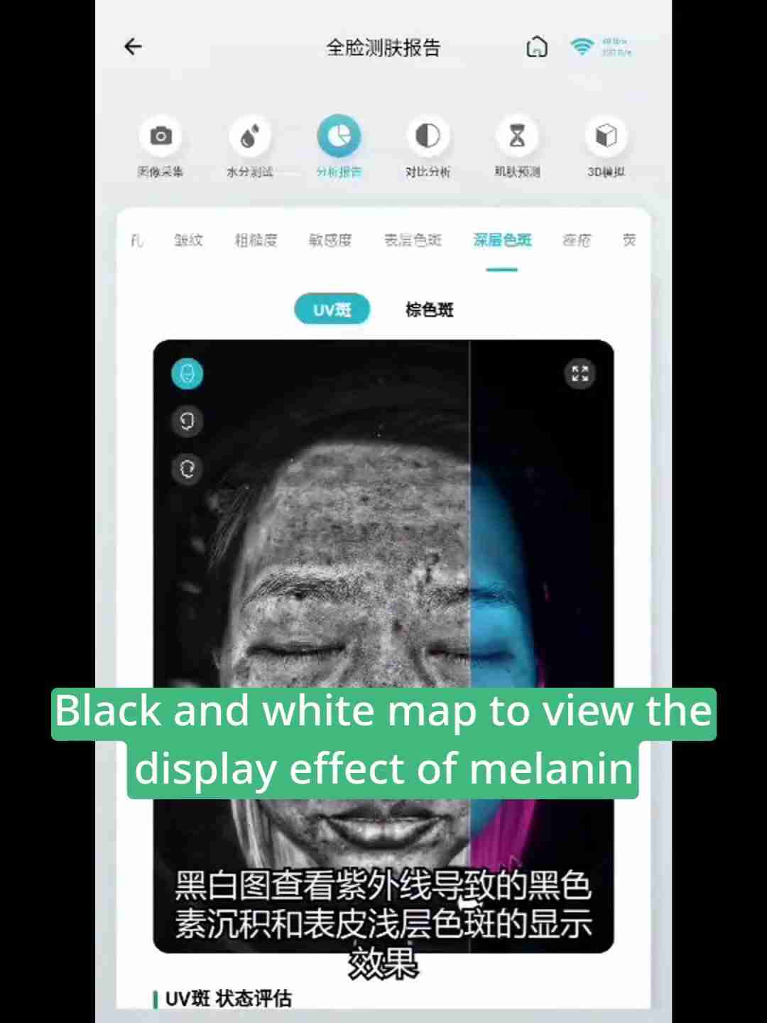 皮肤检测报告解读：深层分析与护理建议