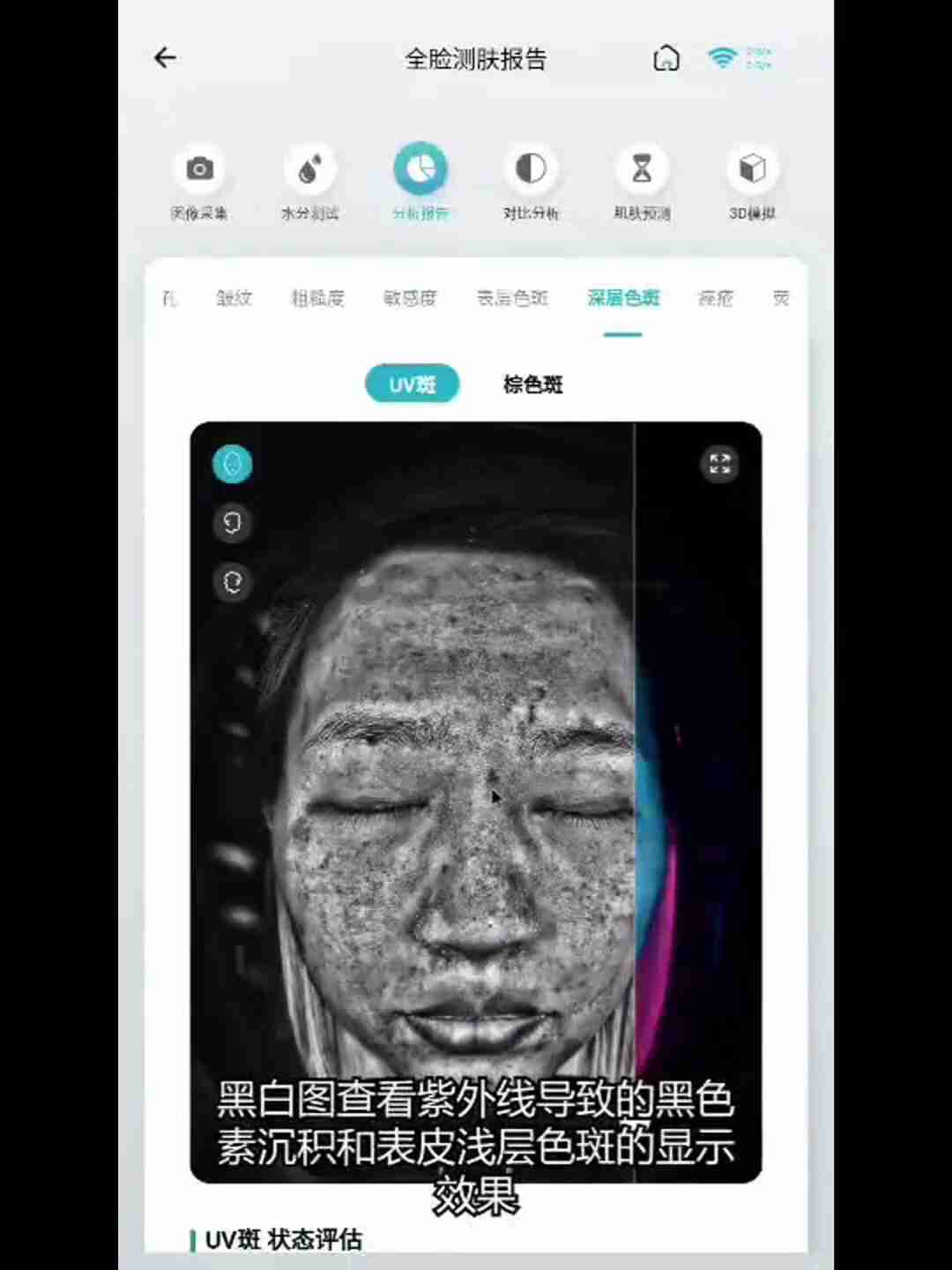 皮肤检测报告解读：深层分析与护理建议