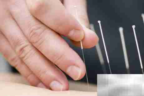 吉林市针灸培训学校地址