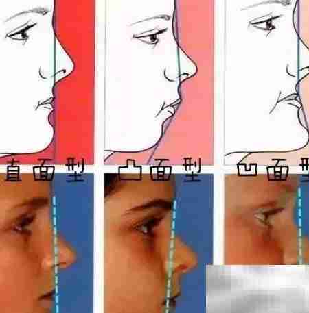 鼻基底恢复自然小技巧