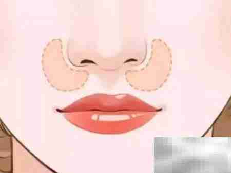 鼻基底恢复自然小技巧