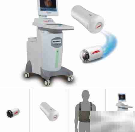 胶囊胃镜的优势解析